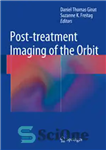 دانلود کتاب Post-treatment Imaging of the Orbit – تصویربرداری پس از درمان از مدار