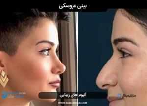 سابلیمینال بینی عروسکی