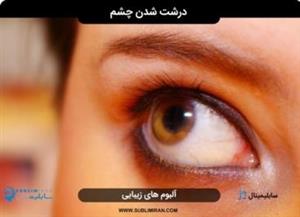 سابلیمینال درشت شدن چشم