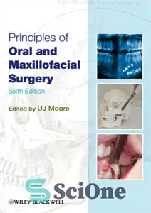 دانلود کتاب Principles of Oral and Maxillofacial Surgery – اصول جراحی دهان و فک و صورت