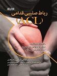 رباط صلیبی قدامی ACL