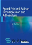 دانلود کتاب Spinal Epidural Balloon Decompression and Adhesiolysis – رفع فشار با بالون اپیدورال نخاعی و چسبندگی