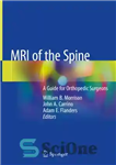 دانلود کتاب MRI of the Spine: A Guide for Orthopedic Surgeons ستون فقرات: راهنمای جراحان ارتوپد 