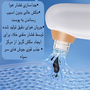 میکرودرم خانگی مدل X17