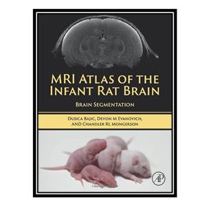 کتاب MRI Atlas of the Infant Rat Brain Segmentation اثر جمعی از نویسندگان انتشارات مؤلفین طلایی 