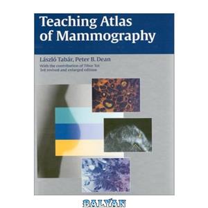 دانلود کتاب Teaching Atlas of Mammography 