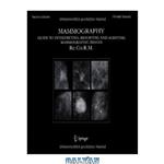 دانلود کتاب Mammography: Guide to Interpreting, Reporting and Auditing Mammographic Images - Re.Co.R.M. (From Italian Reporting and Codifying the Results of Mammography)