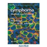 دانلود کتاب Lymphoma (Methods in Molecular Medicine)