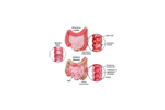 فایل کولیت اولسرو و کرون IBD
