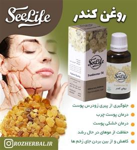 روغن کندر ارغوان سرخ کد 75 حجم 30 میلی لیتر