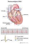 کتاب تفسیر سریع الکتروکاردیوگرام – دانلود (ECG)