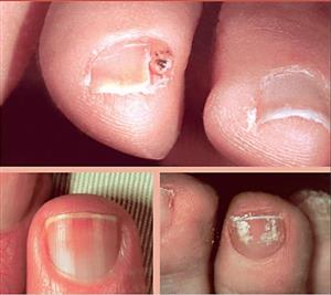 دانلود کتاب آناتومی و بیماری های ناخن