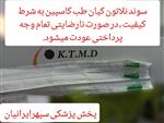 سوند نلاتون کیان طب کاسپین