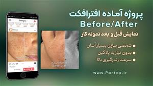 پروژه افترافکت بیفور افتر اینستاگرام