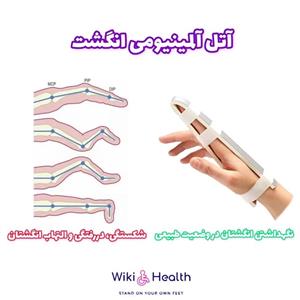 آتل انگشت طب و صنعت مدل آلومینیومی (ویکی هلث)