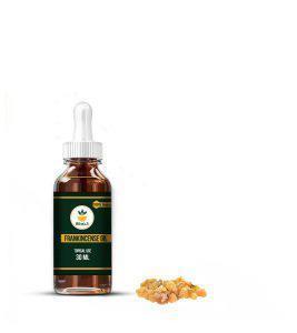 روغن کندر موضعی