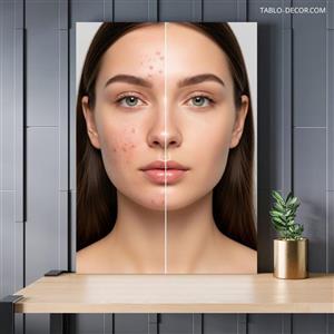 تابلو دکوراتیو کلینیک پوست Skin treatment clinic
