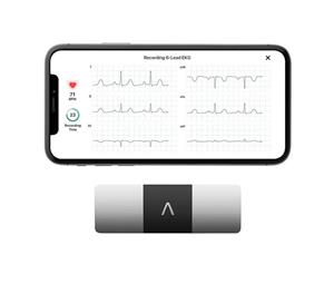 دستگاه نوار قلب قابل حمل AliveCor KardiaMobile 6L