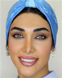 لنز تماسی اکسیژن آی مدل 304