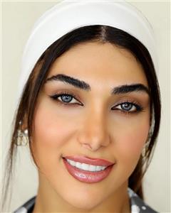 لنز تماسی اکسیژن آی مدل 308