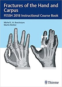 کتاب فرکچرز آف د هند اند کارپوس Fractures of the Hand and Carpus: FESSH 2018 Instructional Course Book 1st Edition, Kindle Editi