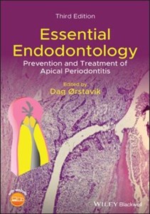 کتاب اسنشال اندودنتولوژی Essential Endodontology : Prevention and Treatment of Apical Periodontitis