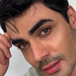 لنز رز–ارکید گرین
