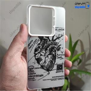 قاب گوشی شیائومی ردمی نوت 14 5G (کاور فانتزی So Cool طرح آناتومی قلب Silver)