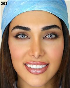 لنز کره ای اکسیژن ای OXYGEN EYE اصل تاریخ جدید قیمت ویژه اکسیژن آی شماره 303