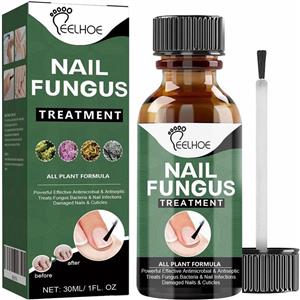 روغن درمان قارچ ناخن FUIN، ترمیم کننده ضد قارچ برای ناخن های آسیب دیده و تغییر رنگ یافته، محلول احیای ناخن سالم، 30 میلی لیتر