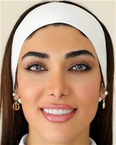لنز چشم تماسی اکسیژن آی 301