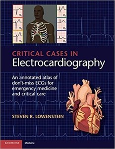دانلود کتاب موارد بحرانی در الکتروکاردیوگرافی Critical Cases in Electrocardiography, 1ed