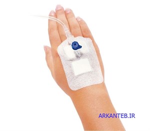 چسب آنژیوکت مدکو ( ارسال از تهران )