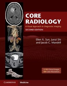 دانلود کتاب رادیولوژی اصلی: رویکرد تصویری به تصویربرداری تشخیصی ۲۰۲۱ Core Radiology: A Visual Approach to Diagnostic Imaging 2021