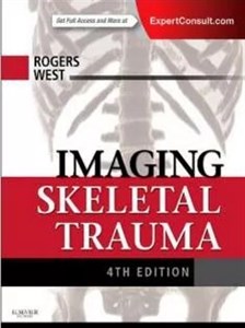 دانلود کتاب Imaging Skeletal Trauma