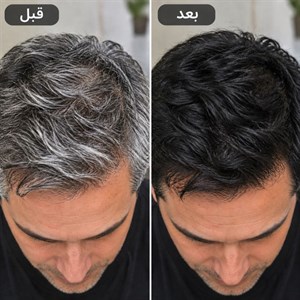 شامپو رنگ مو بابل موس ۵۰۰ میل (پک اورجینال تستردار)