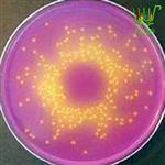 محیط کشت (Glucose Bromocresol Purple Agar (Tryptone Yeast