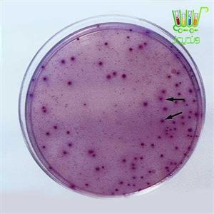 محیط کشت Violet Red Bile Lactose Agar (Violet Red Bile Lactose Agar (VRBLA