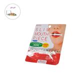 دستگاه اصلاح لبخند و تقویت عضلات گونه نوبل مدل Slim Mouth Piece