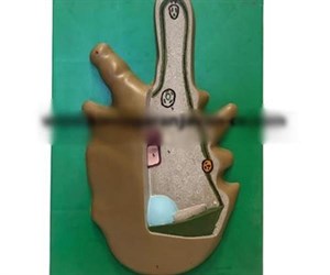 مولاژ آمیب (تک سلولی)