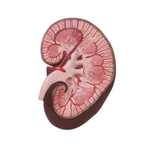 مولاژ کلیه دیواری