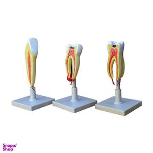بازی آموزشی طرح مولاژ دندان مدل ASM43 مجموعه 3 عددی