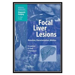 کتاب Focal Liver Lesions Detection, Characterization, Ablation اثر جمعی از نویسندگان انتشارات مؤلفین طلایی 