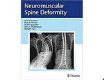 کتاب Neuromuscular Spine Deformity 1st Edition2018