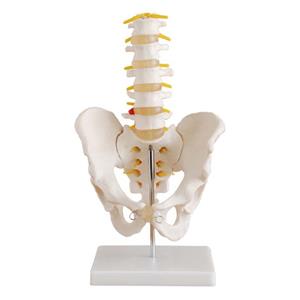 مولاژ لگن خاصره با پنج مهره تحتانی مدل XC-115