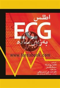 ECG به زبان ساده