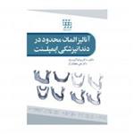 کتاب آنالیز المان محدود در دندانپزشکی ایمپلنت نشر شایان نمودار