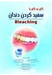 کتاب گام به گام با سفید کردن دندان (Bleaching) نشر رویان پژو
