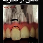 کتاب صدمات دندانی ناشی از ضربه نشر رویان پژو