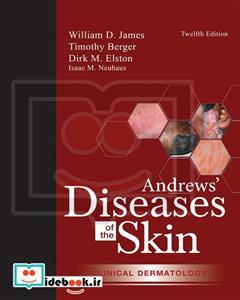 Andrews Diseases of the Skin 